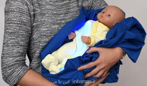 روش جدید درمان زردی نوزاد