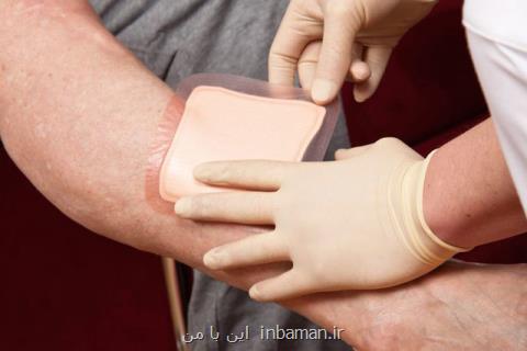 مسئله زخم متولی خاصی در كشور ندارد، احتمال فوت 45 درصدی مبتلایان به زخم پای دیابتی