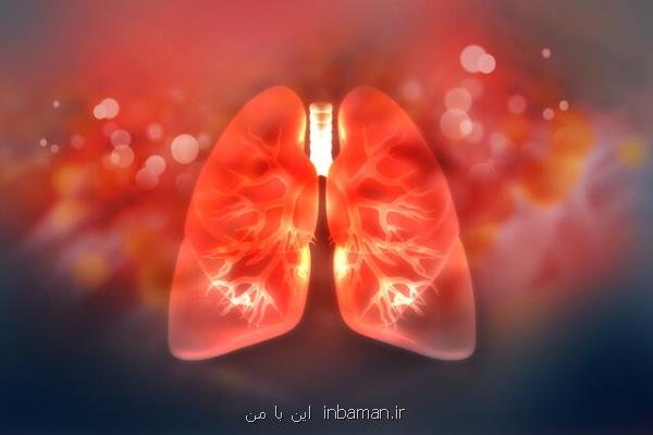 تهیه اولین نقشه مولكولی از ریه برای كمك به بازسازی آن